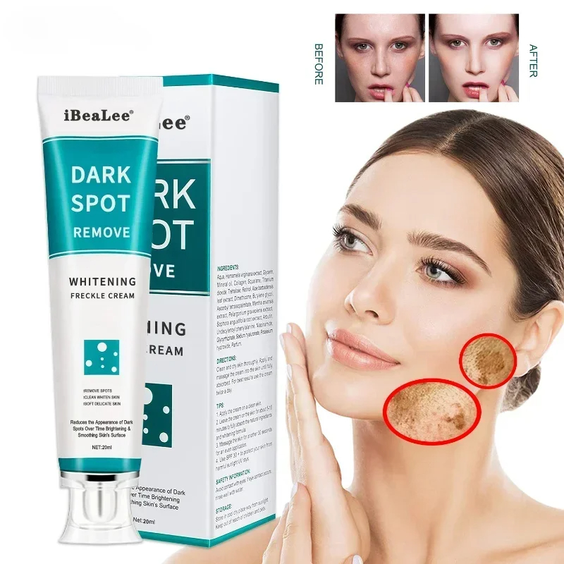 Retinol Cream - Clareamento creme de sardas remover manchas