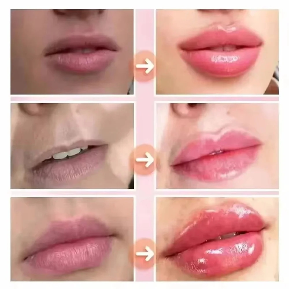 Bálsamo Labial de Aumento Rápi - Lip Balm avaliação e preço