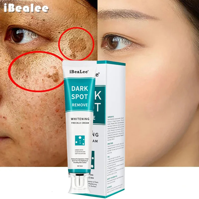 Clareamento creme de sardas re - Retinol Cream avaliação e preço