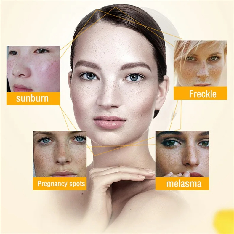 Clareamento creme de sardas re - Retinol Cream avaliação e preço