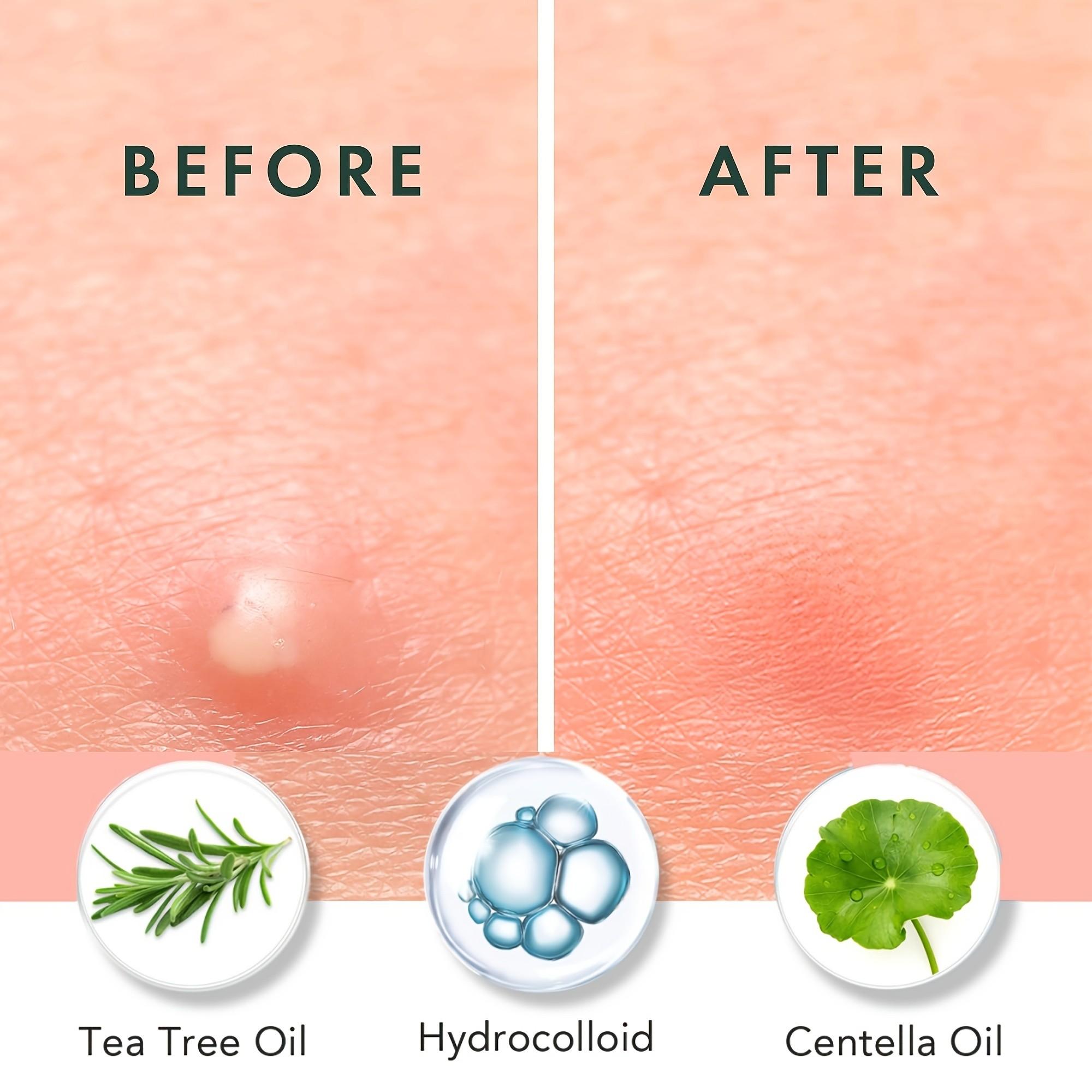 180/360/720 unidades de adesiv - Face Oil avaliação e preço