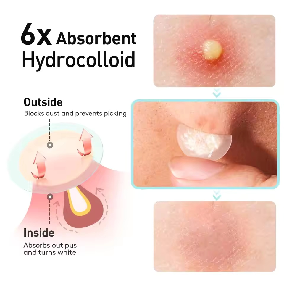 375 peças/caixa de remendos tr - Face Oil avaliação e preço